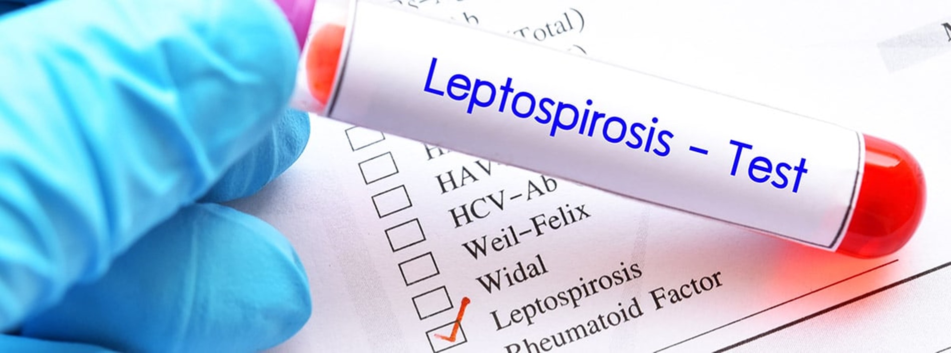 Blood sample tube for Leptospirosis test